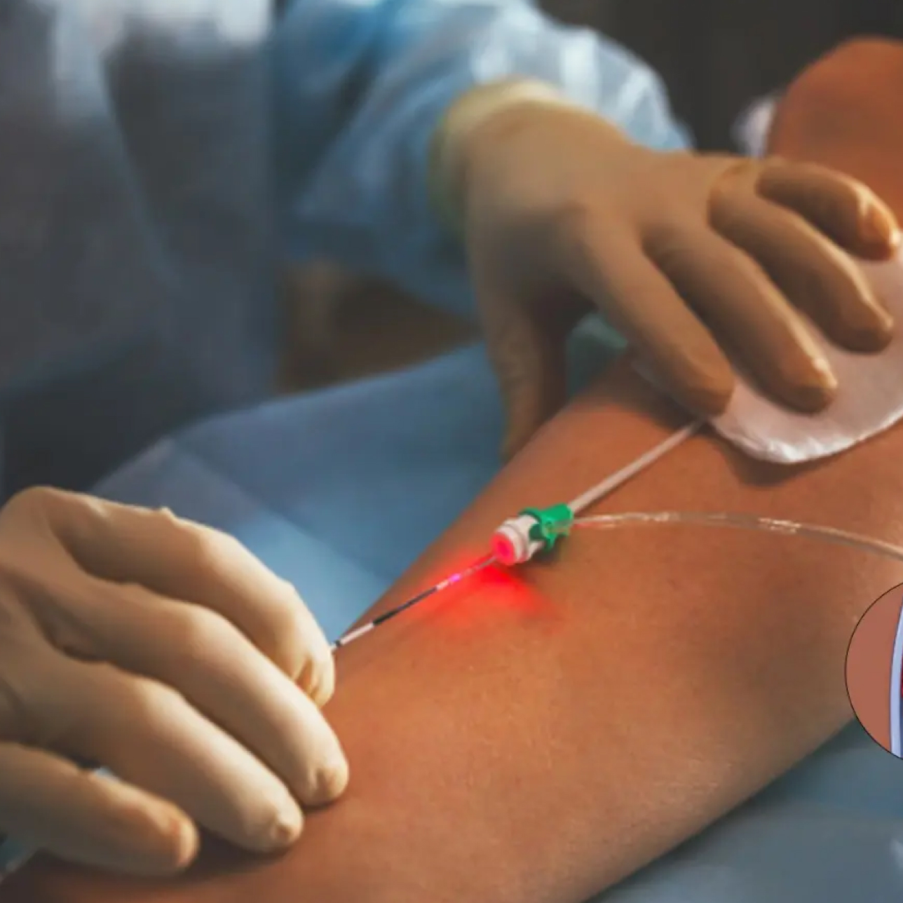 Laparoscopic Surgery